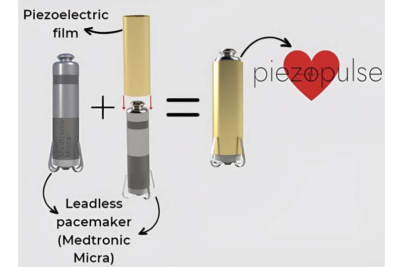 Perangkat mengumpulkan energi detak jantung untuk memperpanjang masa pakai baterai alat pacu jantung